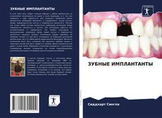 ЗУБНЫЕ ИМПЛАНТАНТЫ的封面