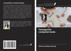 Copertina di Tomografía computarizada