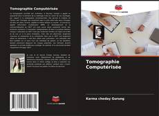 Buchcover von Tomographie Computérisée