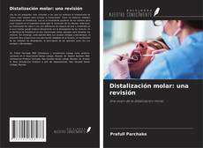 Buchcover von Distalización molar: una revisión