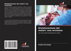 Bookcover of Distalizzazione dei molari: una revisione
