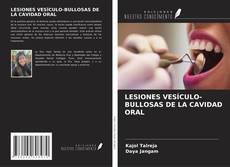 Buchcover von LESIONES VESÍCULO-BULLOSAS DE LA CAVIDAD ORAL