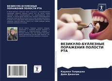Bookcover of ВЕЗИКУЛО-БУЛЛЕЗНЫЕ ПОРАЖЕНИЯ ПОЛОСТИ РТА
