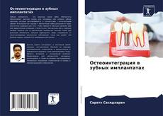 Buchcover von Остеоинтеграция в зубных имплантатах