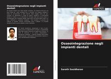 Buchcover von Osseointegrazione negli impianti dentali