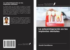 Bookcover of La osteointegración en los implantes dentales