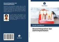 Обложка Osseointegration bei Zahnimplantaten