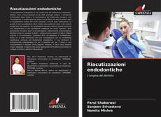 Buchcover von Riacutizzazioni endodontiche