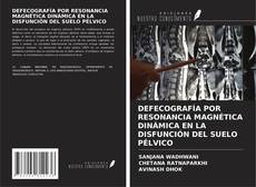 DEFECOGRAFÍA POR RESONANCIA MAGNÉTICA DINÁMICA EN LA DISFUNCIÓN DEL SUELO PÉLVICO的封面
