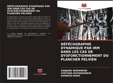 Bookcover of DÉFÉCOGRAPHIE DYNAMIQUE PAR IRM DANS LES CAS DE DYSFONCTIONNEMENT DU PLANCHER PELVIEN