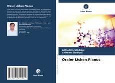 Bookcover of Oraler Lichen Planus