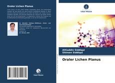 Oraler Lichen Planus的封面