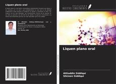 Couverture de Liquen plano oral