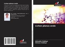 Lichen planus orale kitap kapağı
