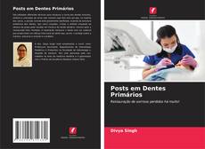 Buchcover von Posts em Dentes Primários