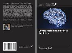 Copertina di Comparación hemisférica del ictus