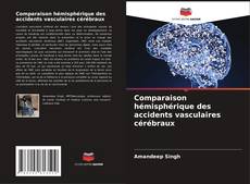 Copertina di Comparaison hémisphérique des accidents vasculaires cérébraux