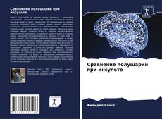 Обложка Сравнение полушарий при инсульте