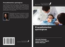 Copertina di Procedimientos quirúrgicos