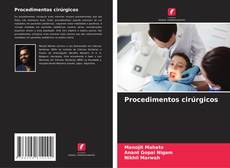 Procedimentos cirúrgicos kitap kapağı