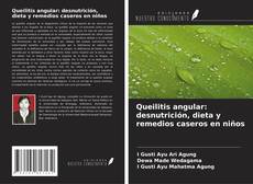 Buchcover von Queilitis angular: desnutrición, dieta y remedios caseros en niños