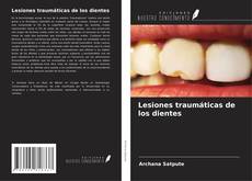 Bookcover of Lesiones traumáticas de los dientes