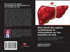 Couverture de État actuel des agents synthétiques et antioxydants sur les maladies du foie