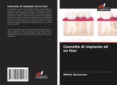 Bookcover of Concetto di impianto all on four
