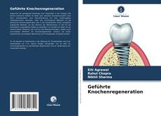 Buchcover von Geführte Knochenregeneration