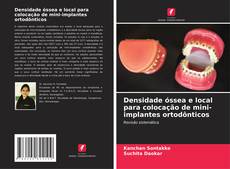 Bookcover of Densidade óssea e local para colocação de mini-implantes ortodônticos