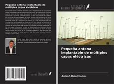 Bookcover of Pequeña antena implantable de múltiples capas eléctricas