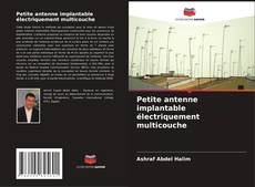 Buchcover von Petite antenne implantable électriquement multicouche