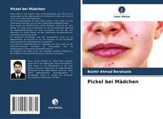 Bookcover of Pickel bei Mädchen