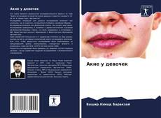 Bookcover of Акне у девочек