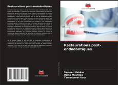 Buchcover von Restaurations post-endodontiques