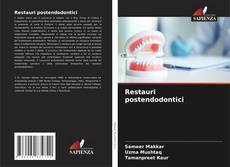 Bookcover of Restauri postendodontici