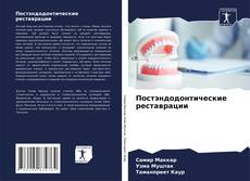 Buchcover von Постэндодонтические реставрации