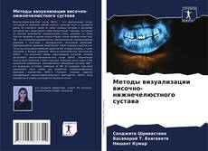 Borítókép a  Методы визуализации височно-нижнечелюстного сустава - hoz