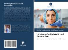 Portada del libro de Lichtempfindlichkeit und Dermatose