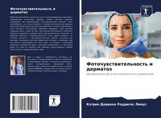 Borítókép a  Фоточувствительность и дерматоз - hoz