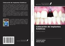 Couverture de Colocación de Implantes Estéticos
