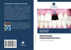 Capa do livro de Ästhetische Implantatinsertion 