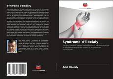 Bookcover of Syndrome d'Elbeialy