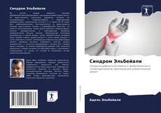 Bookcover of Синдром Эльбейали