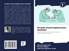 Bookcover of Острая мезентериальная ишемия