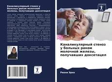 Copertina di Каналикулярный стеноз у больных раком молочной железы, получавших доксетацел