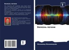 Bookcover of Болезнь печени