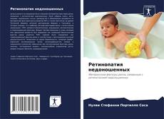 Copertina di Ретинопатия недоношенных