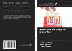 Bookcover of Protocolos de carga de implantes