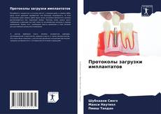 Bookcover of Протоколы загрузки имплантатов